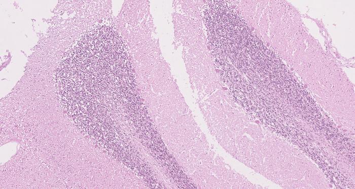new-research-sheds-light-on-the-complexities-of-cancer-predisposition