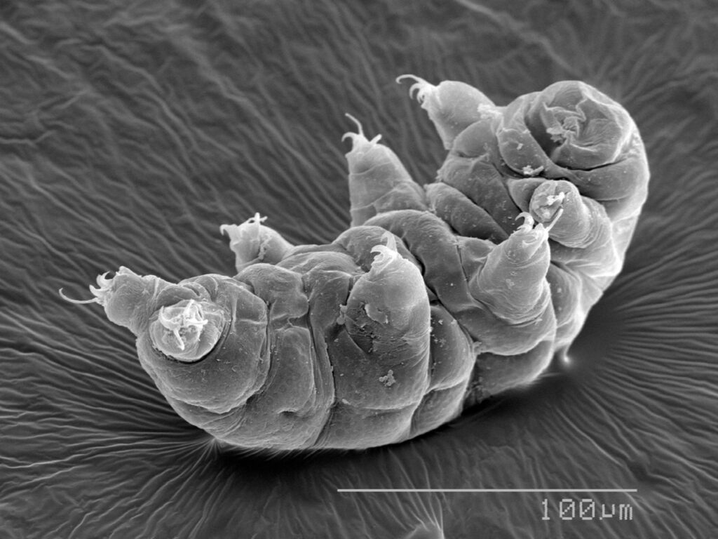tardigrade-protein-protects-healthy-cells-from-radiation-damage