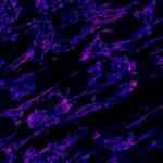 rare-childhood-metabolic-crises-explained-by-fat-transport-deficiency