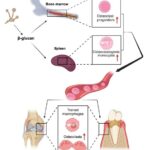 innate-immune-training:-a-catalyst-for-increased-inflammatory-bone-loss