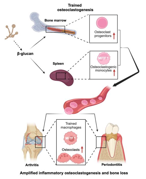 innate-immune-training:-a-catalyst-for-increased-inflammatory-bone-loss