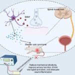 innovative-treatment-approaches-emerging-for-neglected-bladder-disorder