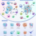 exploring-the-impact-of-tumor-infiltrating-immune-cells-on-endometrial-carcinoma