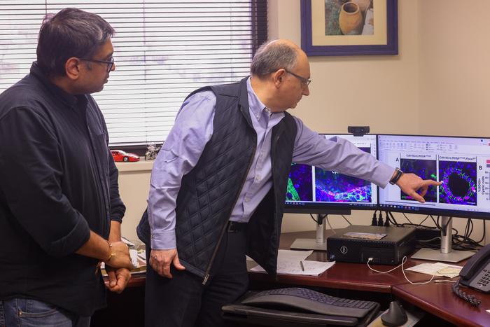 decoding-the-enigmas-of-polycystic-kidney-disease