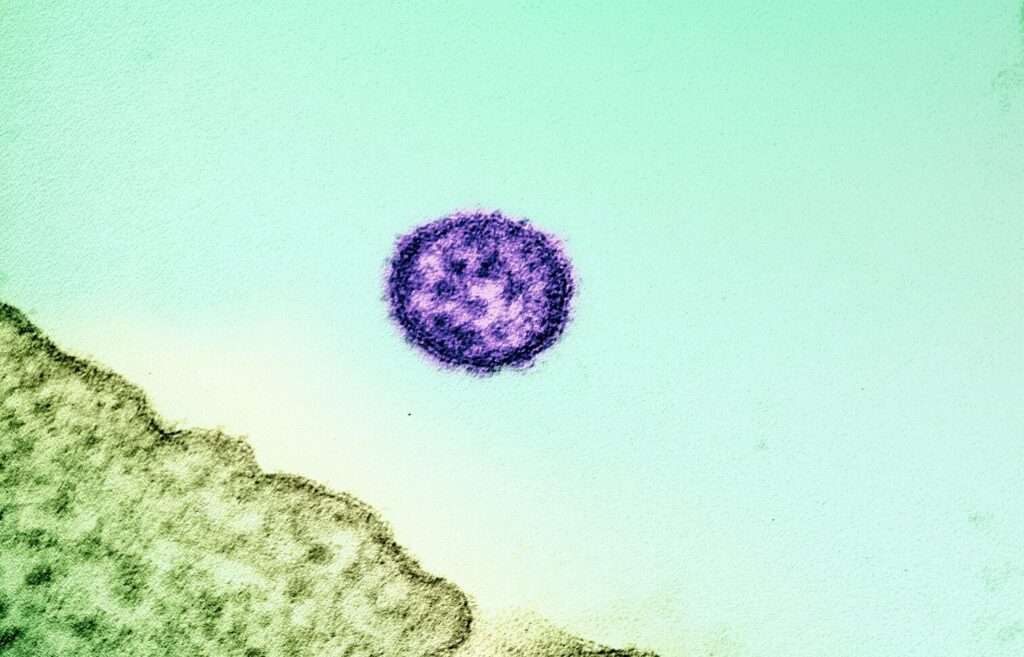 lassa-fever-vaccine-clinical-trial-begins,-marking-key-step-forward