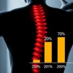 study-reveals-only-10%-of-common-non-surgical,-non-invasive-back-pain-treatments-are-effective
