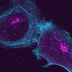 scientists-discover-key-connection-in-autoimmune-disorder-research