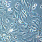 new-analytics-id-metabolite-variations-tied-to-cho-cell-efficiency