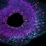 unraveling-the-evolution-of-the-large-brain:-how-did-it-happen?