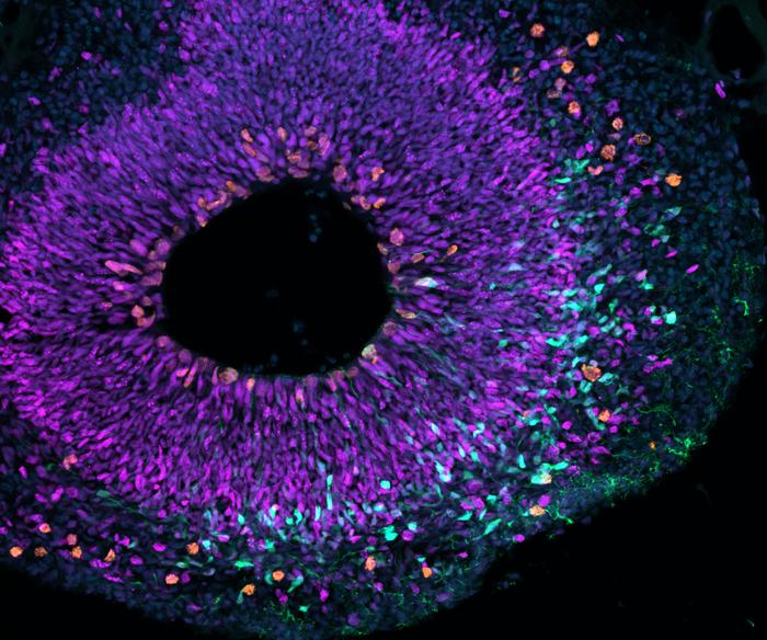 unraveling-the-evolution-of-the-large-brain:-how-did-it-happen?