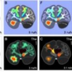mapping-brain-mitochondria:-energy-boost-in-regions-linked-to-advanced-cognition