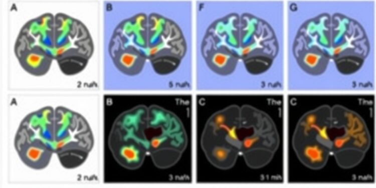 mapping-brain-mitochondria:-energy-boost-in-regions-linked-to-advanced-cognition