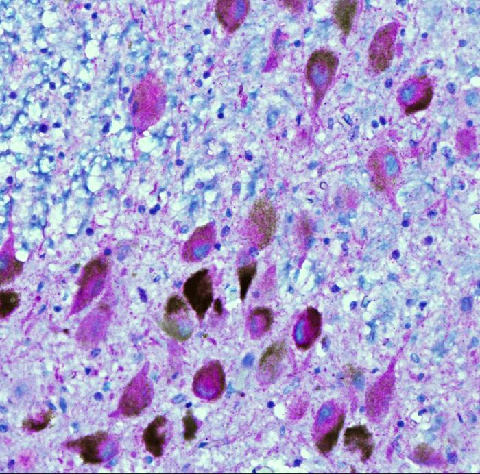 exploring-the-link-between-cholesterol-regulation-and-alzheimer’s-disease-development