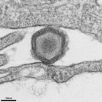 tools-designed-to-develop-african-swine-fever-virus-vaccines-more-efficiently
