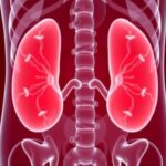 revolutionizing-bladder-cancer-treatment:-how-ai-is-personalizing-oncology-care