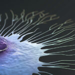 triple-negative-breast-cancer-therapy-resistance-due-to-lipid-accumulation-in-cells