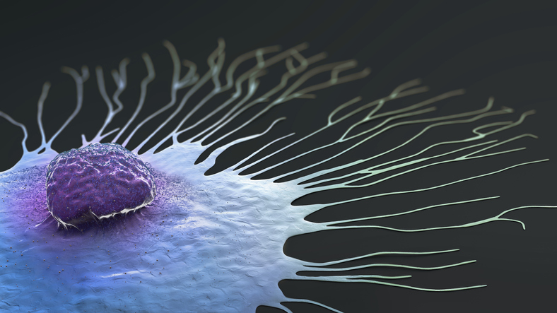triple-negative-breast-cancer-therapy-resistance-due-to-lipid-accumulation-in-cells