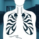 undetected-tb-cases-likely-increased-in-prisons-across-europe-and-the-americas-during-covid-19
