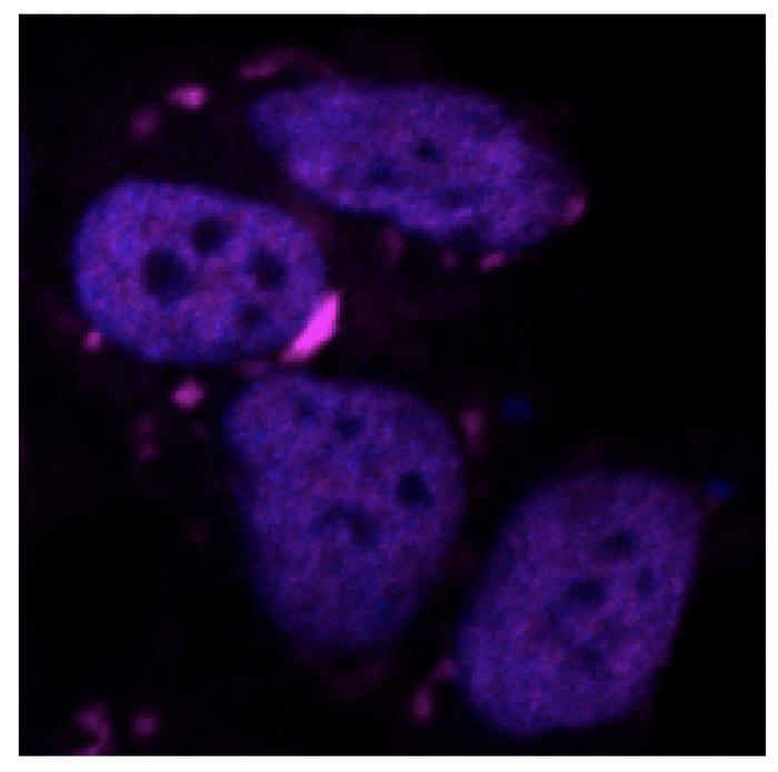 ai-powered-algorithm-targets-proteins-linked-to-brain-damage