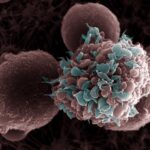 high-fat-diet-linked-to-increased-breast-cancer-metastasis-in-animal-studies