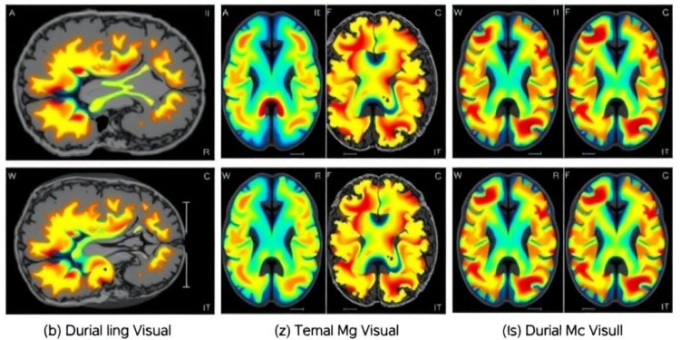 distinct-brain-responses-to-visual-stimuli-observed-in-migraine-sufferers