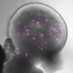 vibrant-pink-skies:-unraveling-the-science-behind-the-stunning-phenomenon