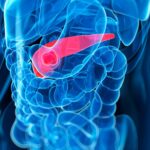 inhibiting-fgfr2-supports-prevention-and-delay-of-common-pancreatic-cancer