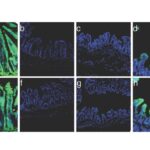 transforming-gut-cells:-a-novel-approach-to-address-small-bowel-syndrome