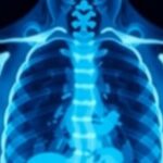 groundbreaking-approach-enhances-accuracy-of-radiologists’-diagnostic-reports