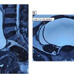 uncommon-co-occurrence-of-ovarian-tumors-detected-in-single-patient