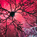 huntington’s-disease-progression-may-be-slowed-by-regenerative-strategy