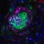 a-gentle-approach-provides-new-promise-for-treating-inflammatory-lung-diseases