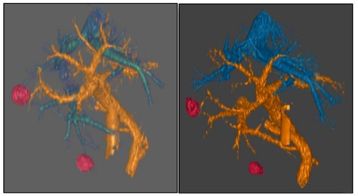 city-of-hope-study-validates-innovative-targeted-strategy-for-treating-pancreatic-cancer