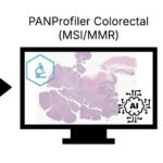 ai-driven-multiomic-biomarker-profiling