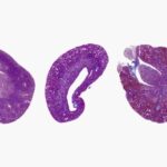 ucla-researchers-unveil-precision-medicine-strategy-to-prevent-kidney-failure