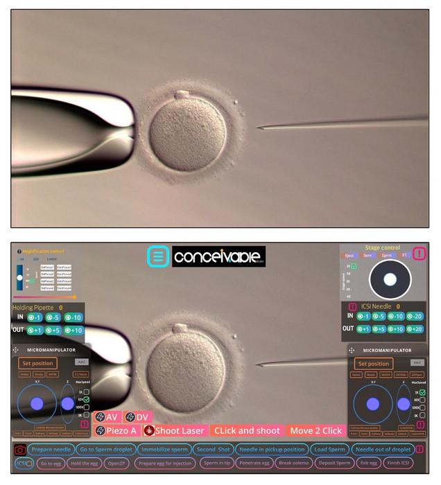 historic-milestone:-first-successful-birth-achieved-through-fully-automated-remote-icsi-system