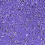 bridging-technologies-renew-hope-for-treating-inflammatory-diseases