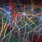 key-neural-pain-sensing-pathway-recreated-in-a-lab-dish