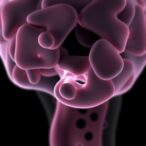 unveiling-kaposi-sarcoma:-demographics-and-survival-insights