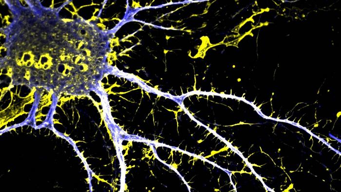 lsd-analog-that-may-have-potential-for-treating-schizophrenia-developed
