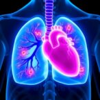 immune-checkpoint-inhibitor-myocarditis-in-lung-cancer