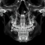 ai-driven-orthodontic-diagnosis-from-lateral-cephalograms
