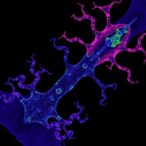 adora2b-drives-growth,-immune-response-in-hnscc