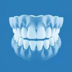 evaluating-digital-enamel-reduction-in-orthodontics