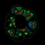 microrna-767-5p-boosts-metastasis,-enhances-therapy-response