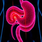identifying-invasive-nodules:-a-crucial-step-to-avoid-unnecessary-pancreatic-cancer-surgeries