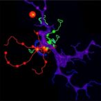 mir-23/24/27-cluster-targets-gsk3β-in-breast-cancer