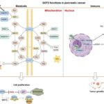 unlocking-a-new-frontier-in-pancreatic-cancer-treatment:-the-therapeutic-potential-of-got2