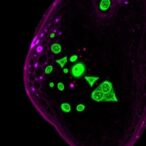 foxo1-controls-mir-99a-5p/e2f7-to-halt-breast-cancer