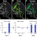 gene-signature-predicts-hnscc-outcomes,-immunity